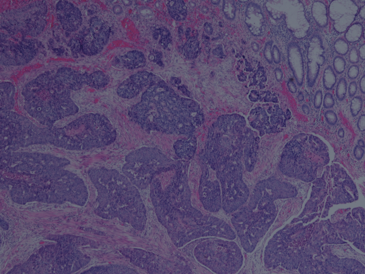  Transform disparate data sources into anonymized, market-ready resources for research, AI development, and drug discovery without building infrastructure from scratch. 