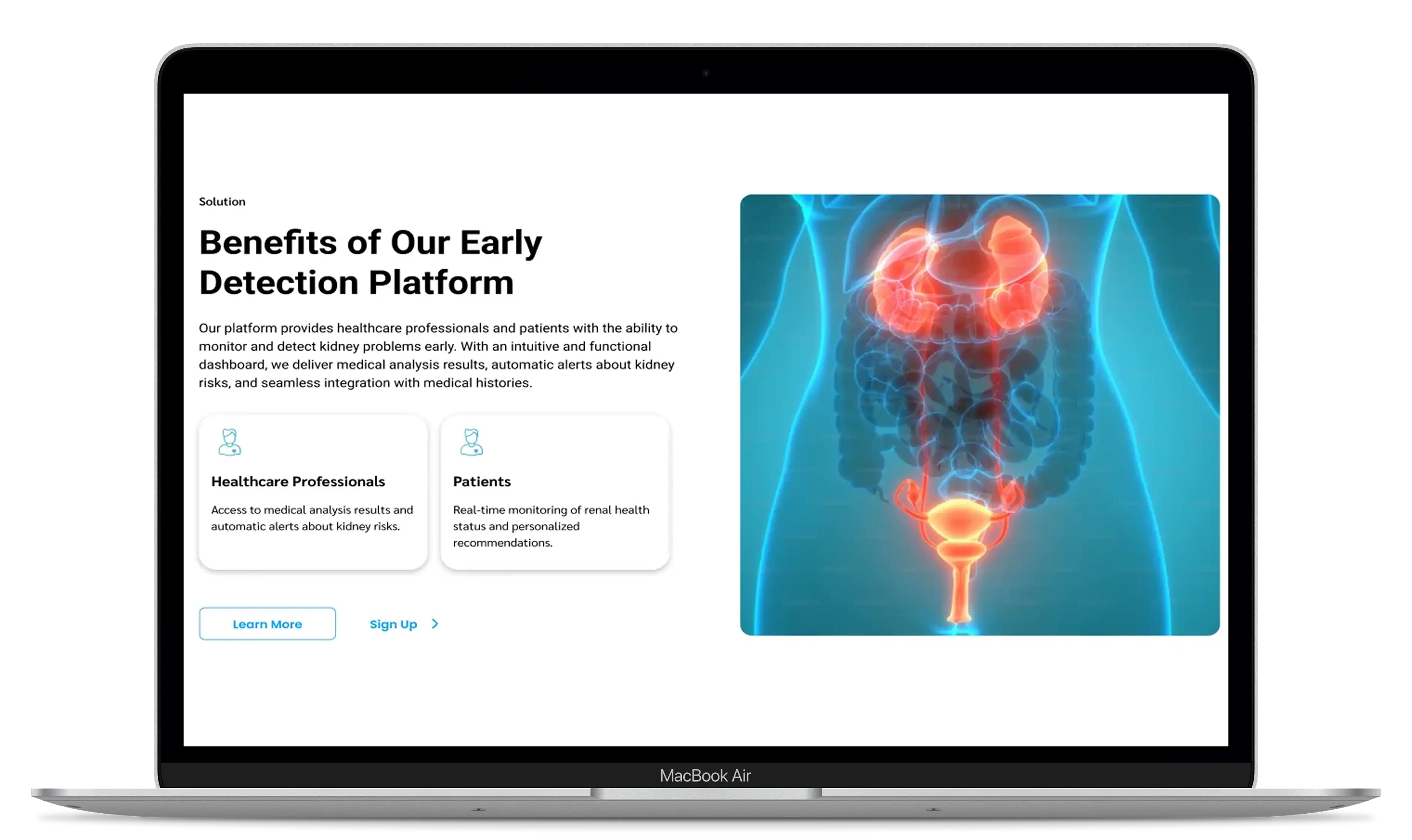 Alerta Temprana early detection platform website