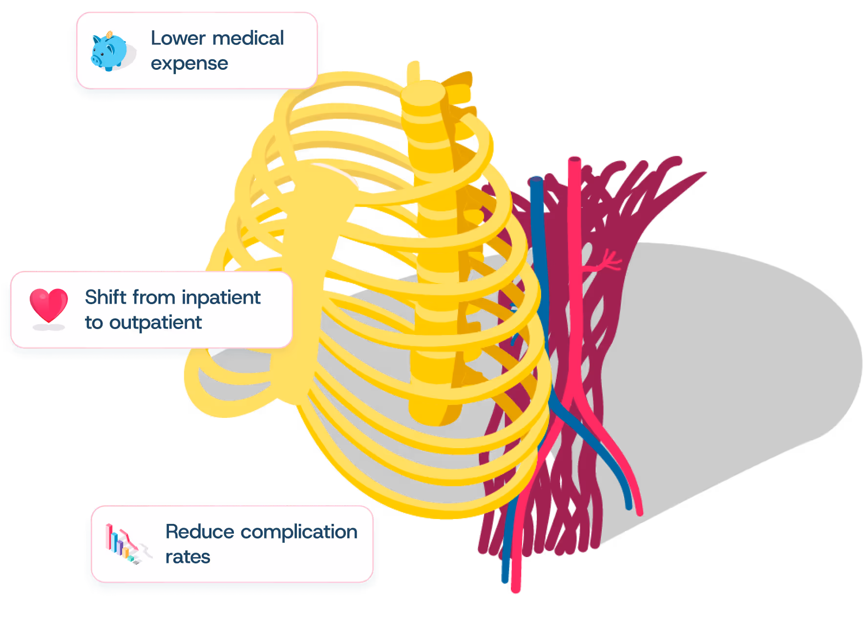 Illustration of a ribcage with surrounding veins and arteries, labeled with lower medical expense, shift to outpatient, and reduced complication rates