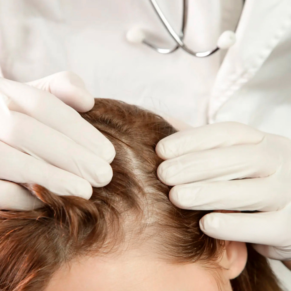 Doctor examining scalp for signs of lice infestation.