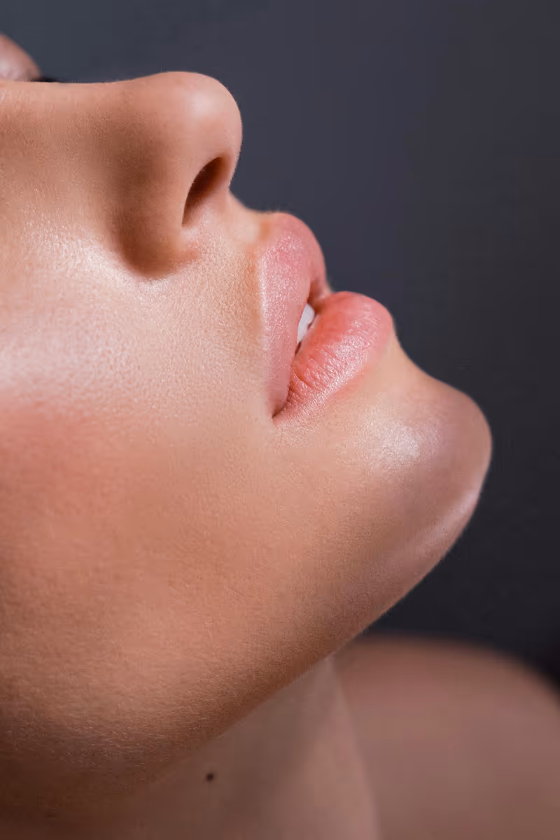 Close-up of smooth, clear skin on woman's face after Hedfirst acne treatment.