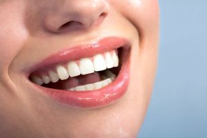 Composite Fillings