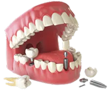 Fremount Star Dental - Dr.Uma Patel DDS