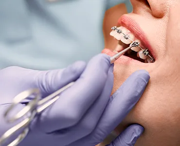 Fremount Star Dental - Dr.Uma Patel DDS