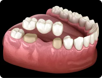 Fremount Star Dental - Dr.Uma Patel DDS