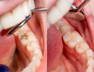 Fremount Star Dental - Dr.Uma Patel DDS