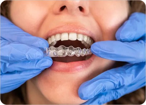 Fremount Star Dental - Dr.Uma Patel DDS