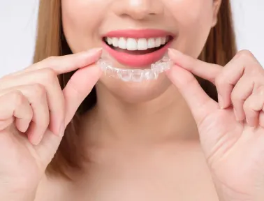How Long Does Invisalign Take in Fremont?