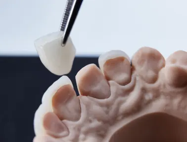 The Complete Guide to Dental Crown Longevity for Fremont Residents