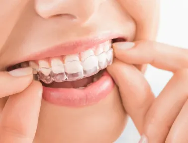 Can You Get Invisalign with a Crown​ in Fremont, CA
