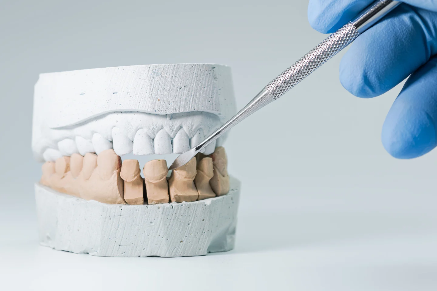 teeth impression mold for dental crown