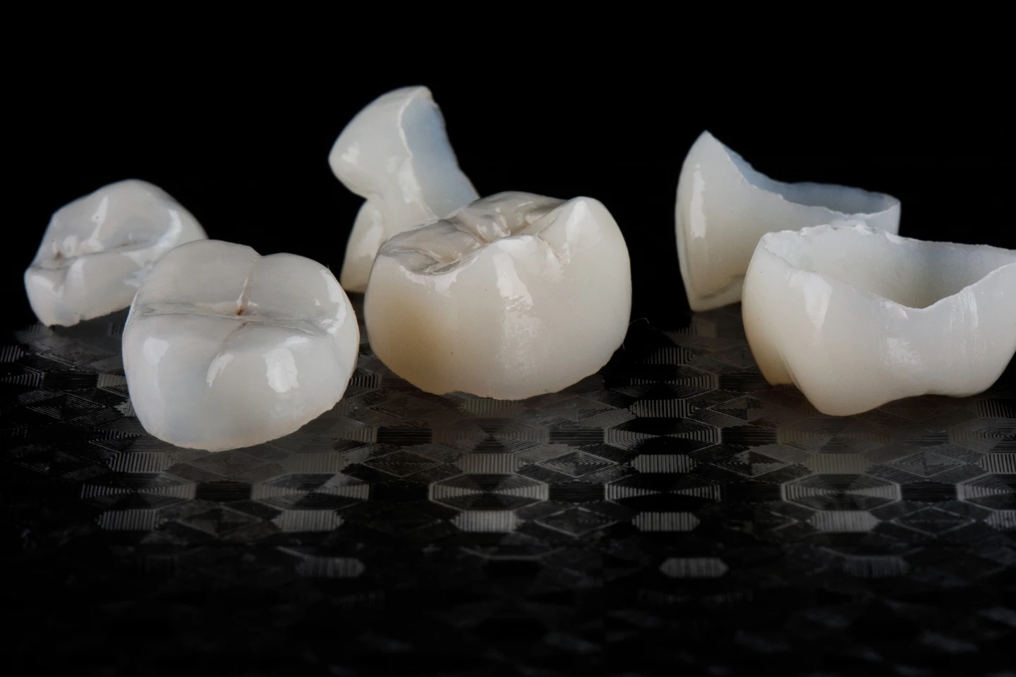 Does Delta Dental Cover Crowns in Fremont? Your Complete Guide