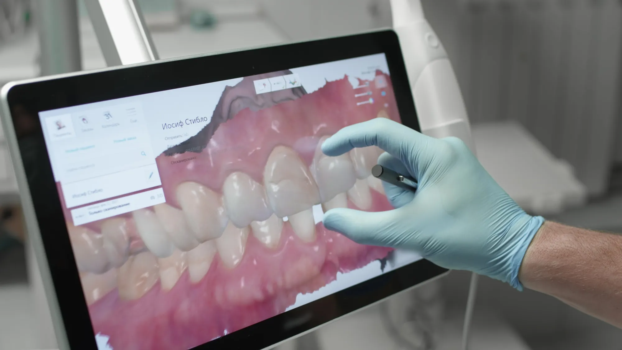 Dentist reviewing a digital 3D scan of a patient's teeth