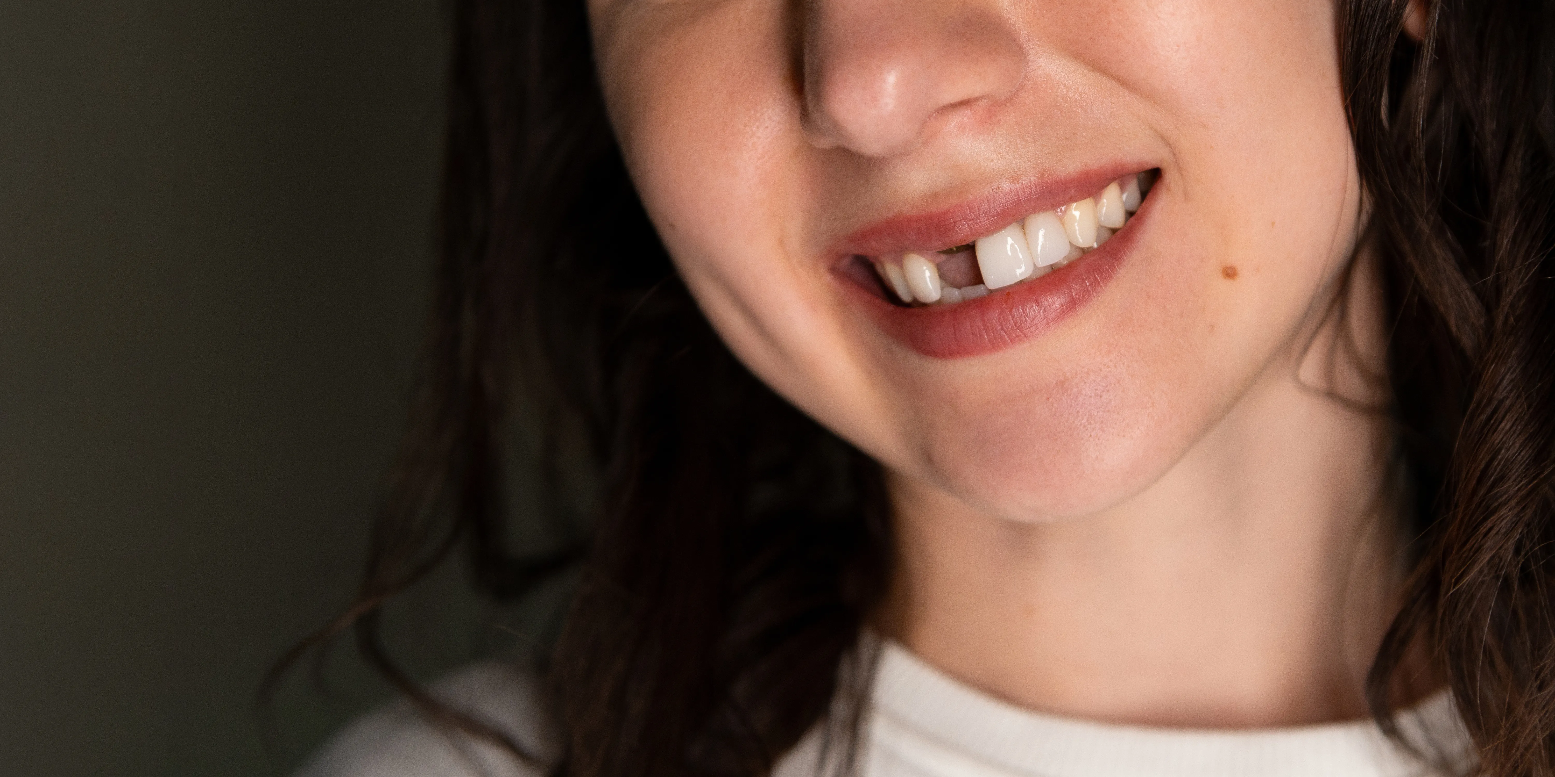 Smiling woman with a visible missing front tooth