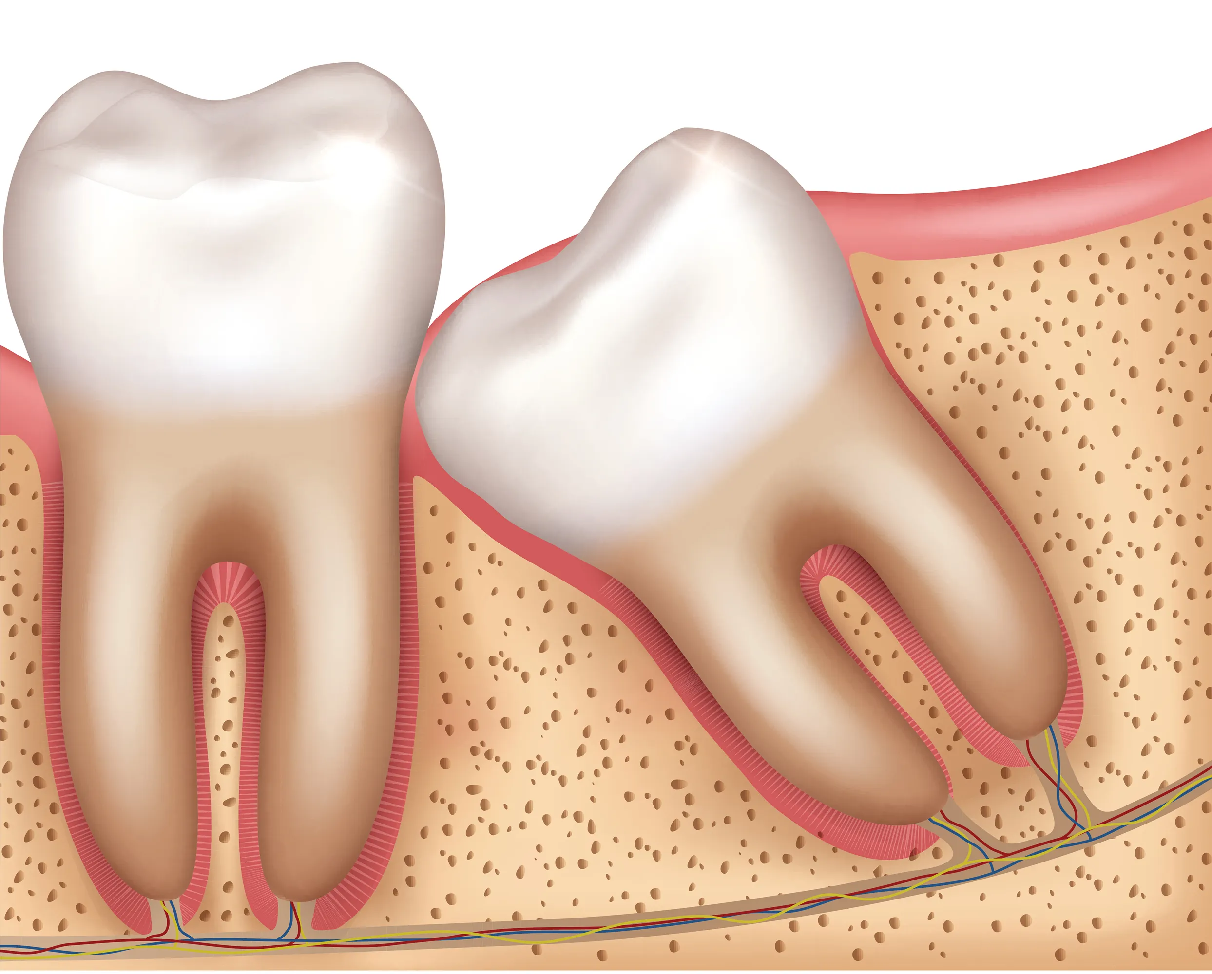 Impacted or Partially Erupted Teeth