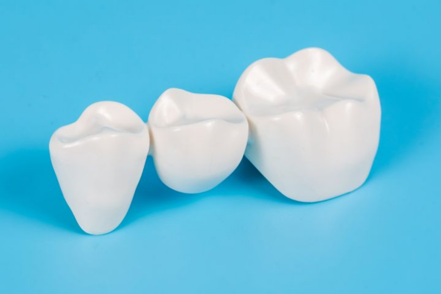 Dental Crowns in Milpitas