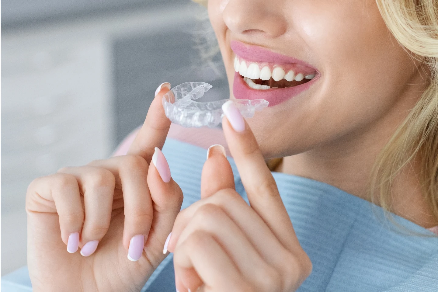 Does Aetna Cover Invisalign?