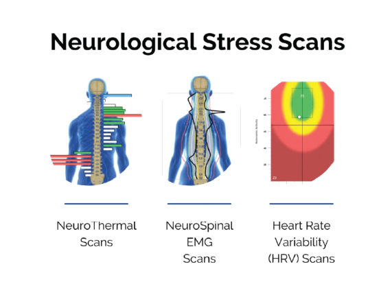 Neurological Stress Scan Examples