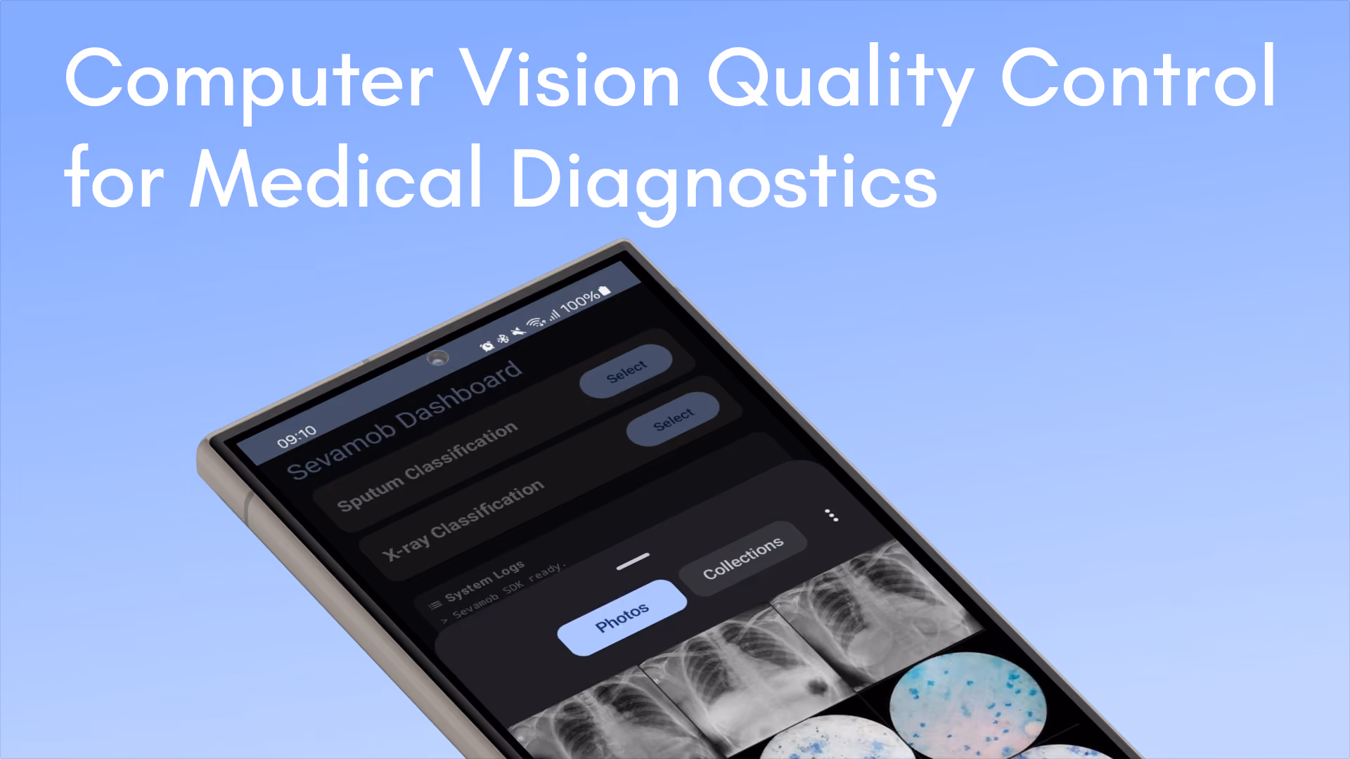 Computer Vision Quality Control for Medical Diagnostics