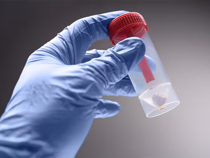 What Does a Comprehensive Stool Analysis Show?