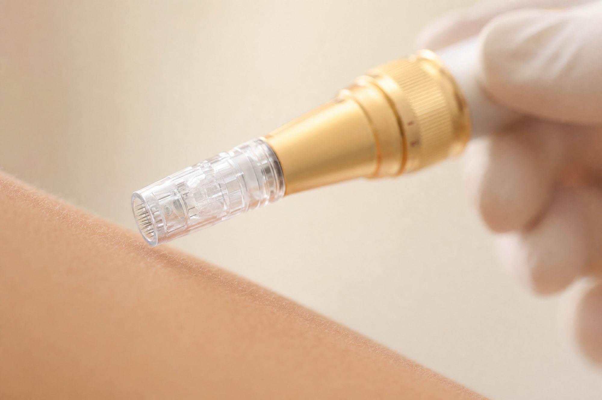 Microneedling at Aluna Aesthetics