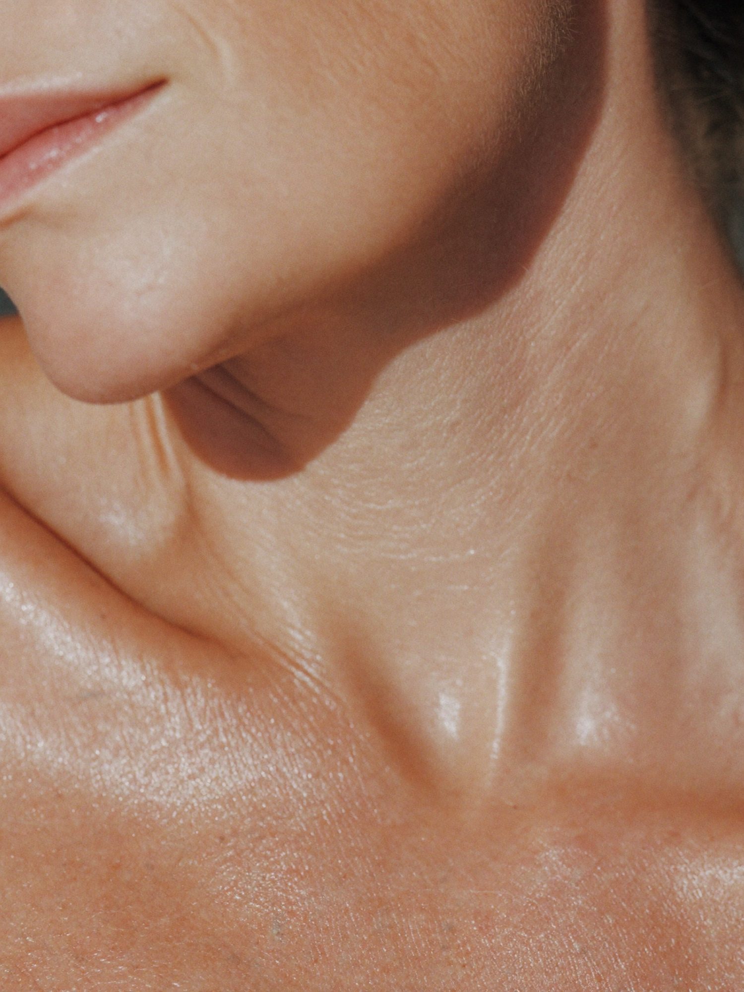 Collagen stimulators and skin boosters at Aluna Aesthetics