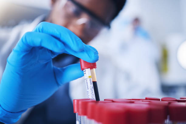 Close-up of blood sample being prepared for biomarker testing for men