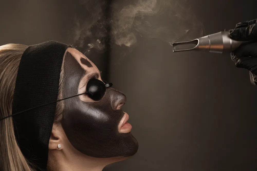 Chemical peel treatment at Asha MedSpa
