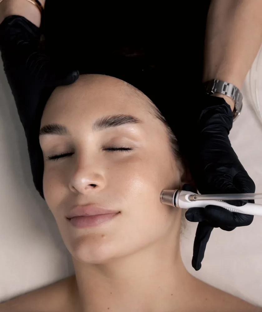 Microdermabrasion treatment at Asha MedSpa