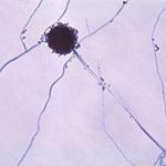 Aspergillus Mold