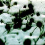 Stachybotrys Mold