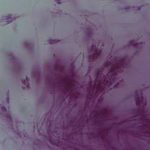 Penicillium Mold