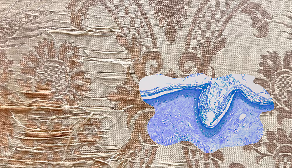 A landscape image of rubbed and worn Irish damask pink linen photographed up close in the Senate Chamber at Stormont Estate, East Belfast. The linen has an intricate regal and floral pattern woven into it. Overlaid onto the photograph in the lower right corner is an interjecting scientific microscopic image of a chronic, inflammatory, non-contagious, lichen-like skin condition in a pale blue hue.
