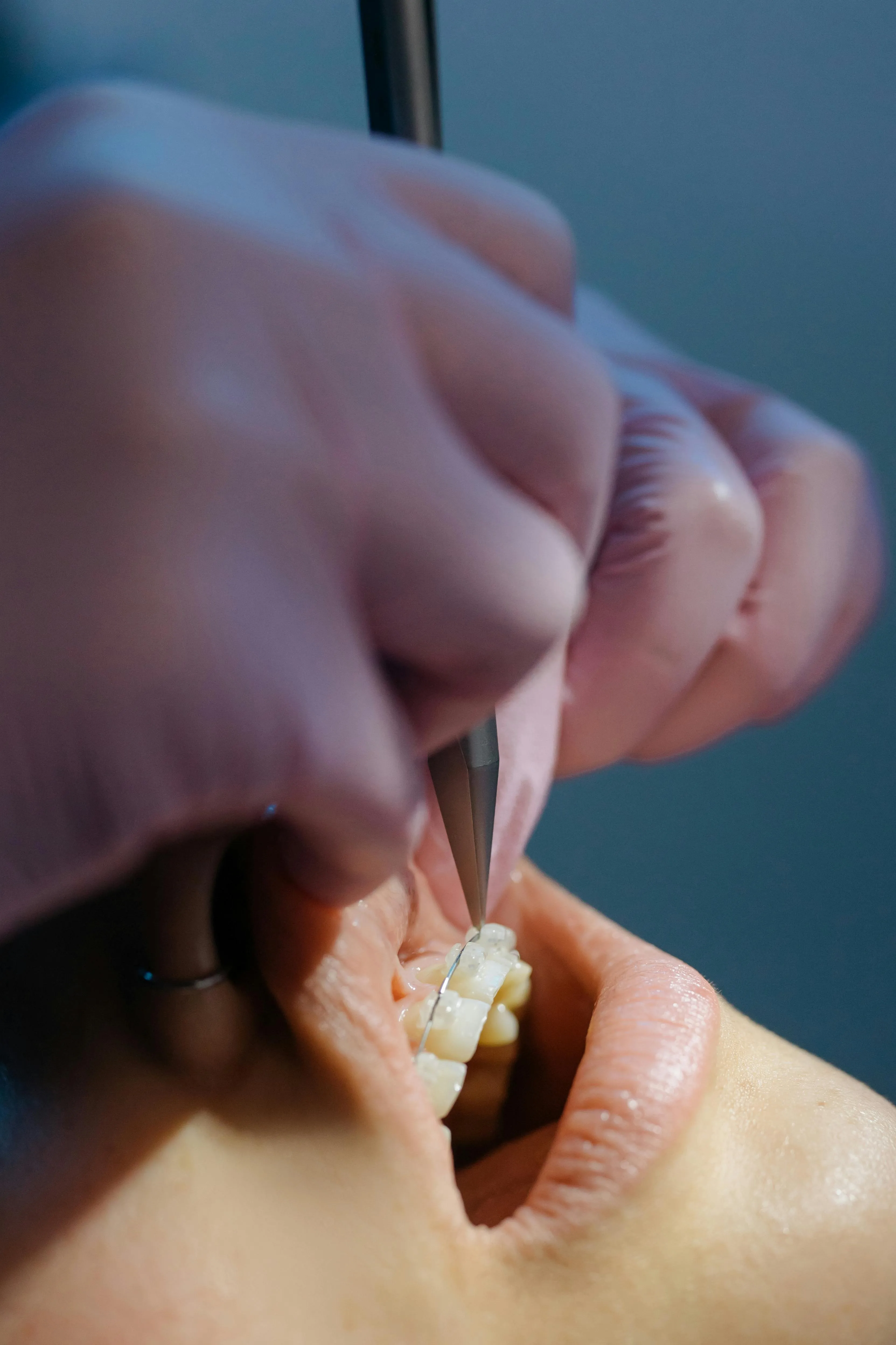 Oral Health Exam