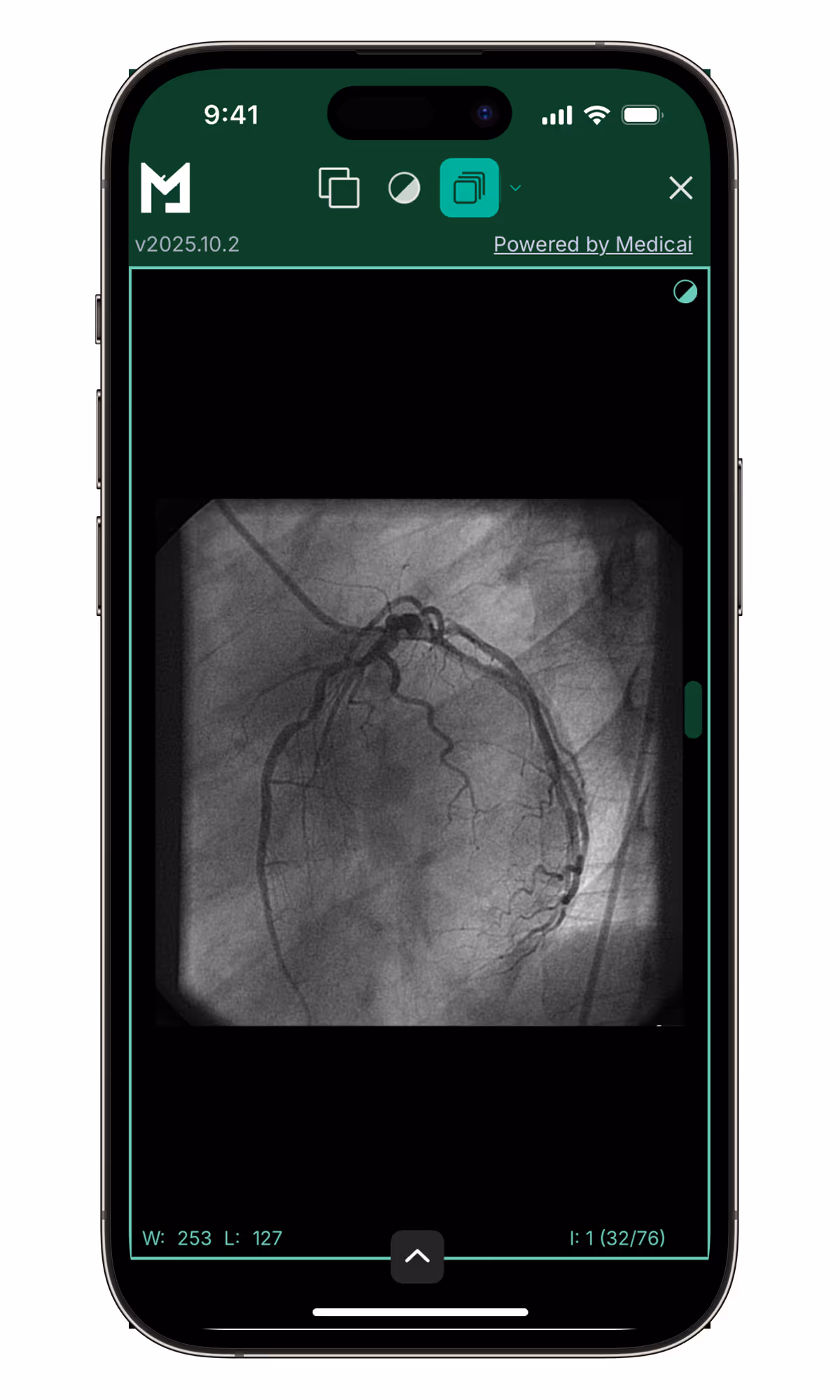 Screen of Medicai Mobile App showing the DICOM Viewer