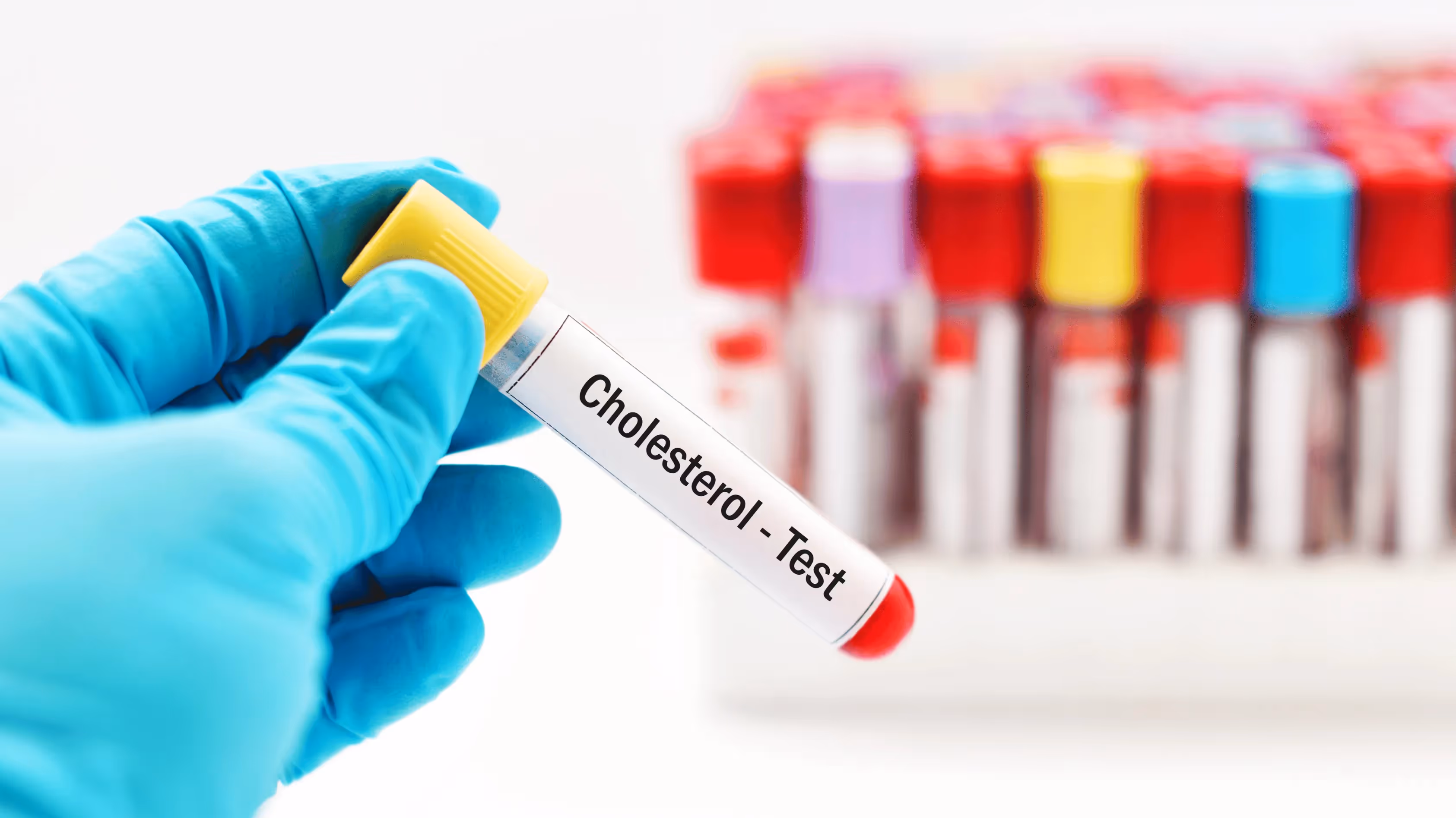 Cholesterol jakie są normy