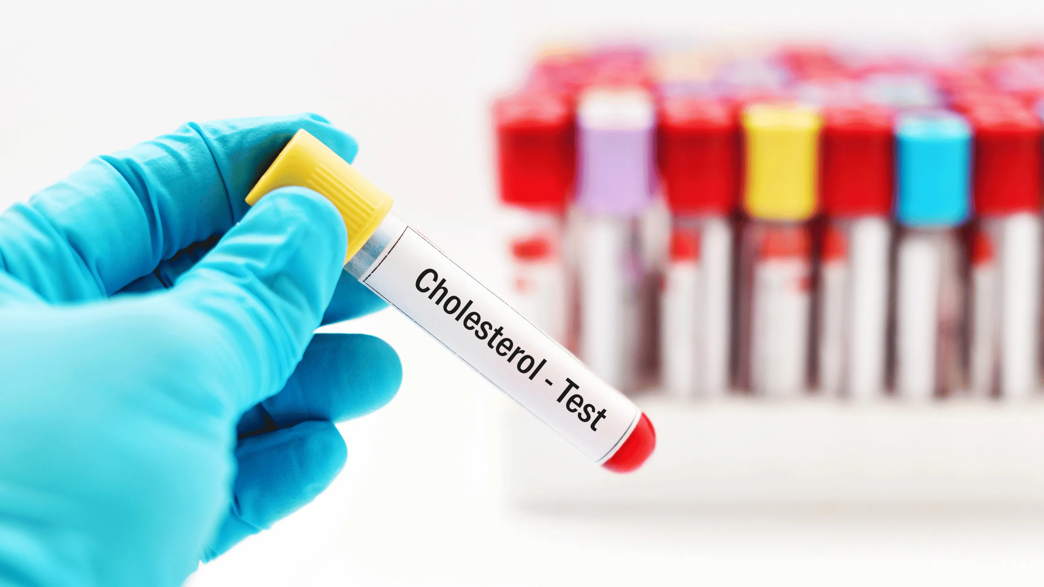 Cholesterol jakie są normy