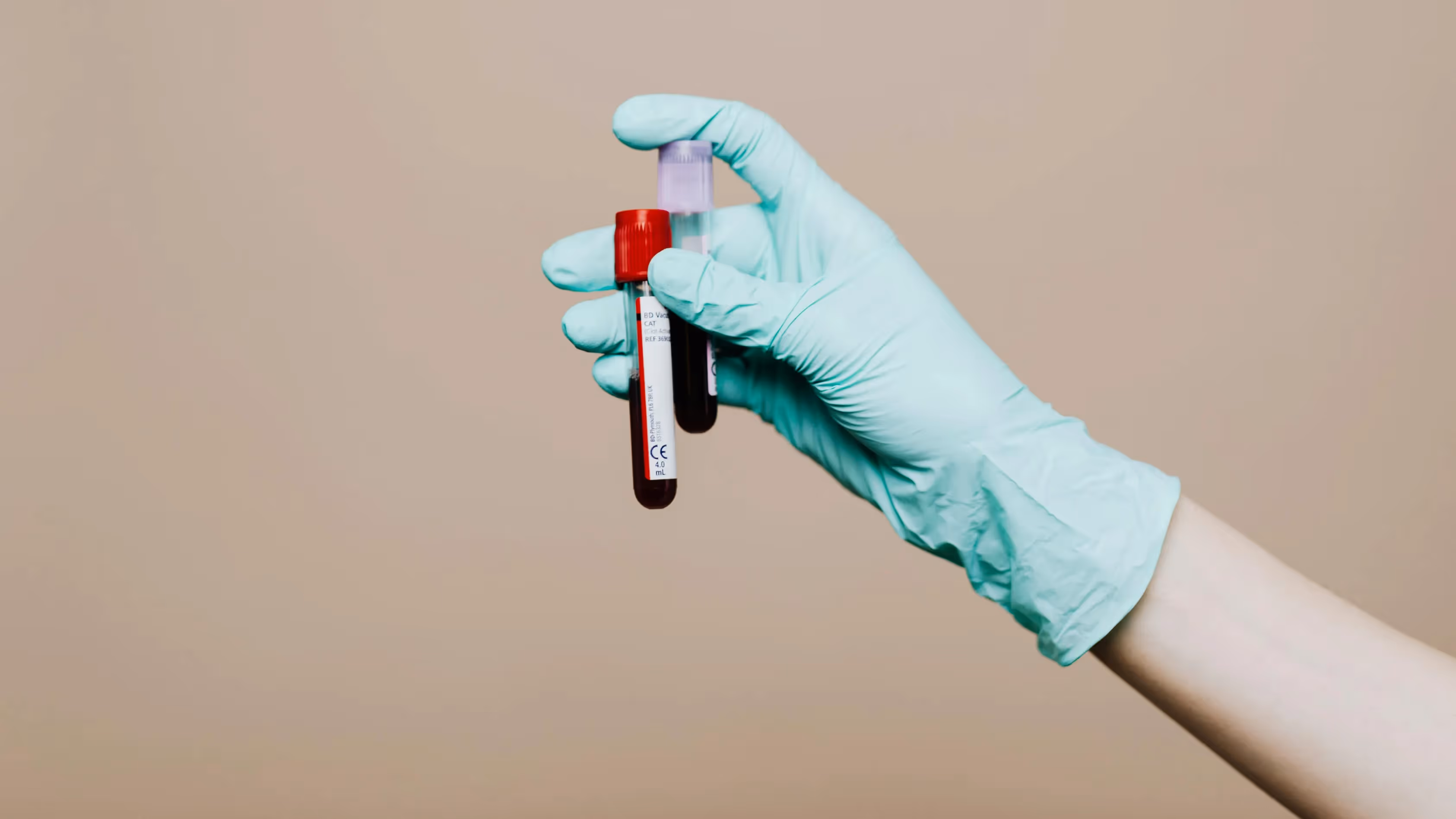 podwyższone trójglicerydy