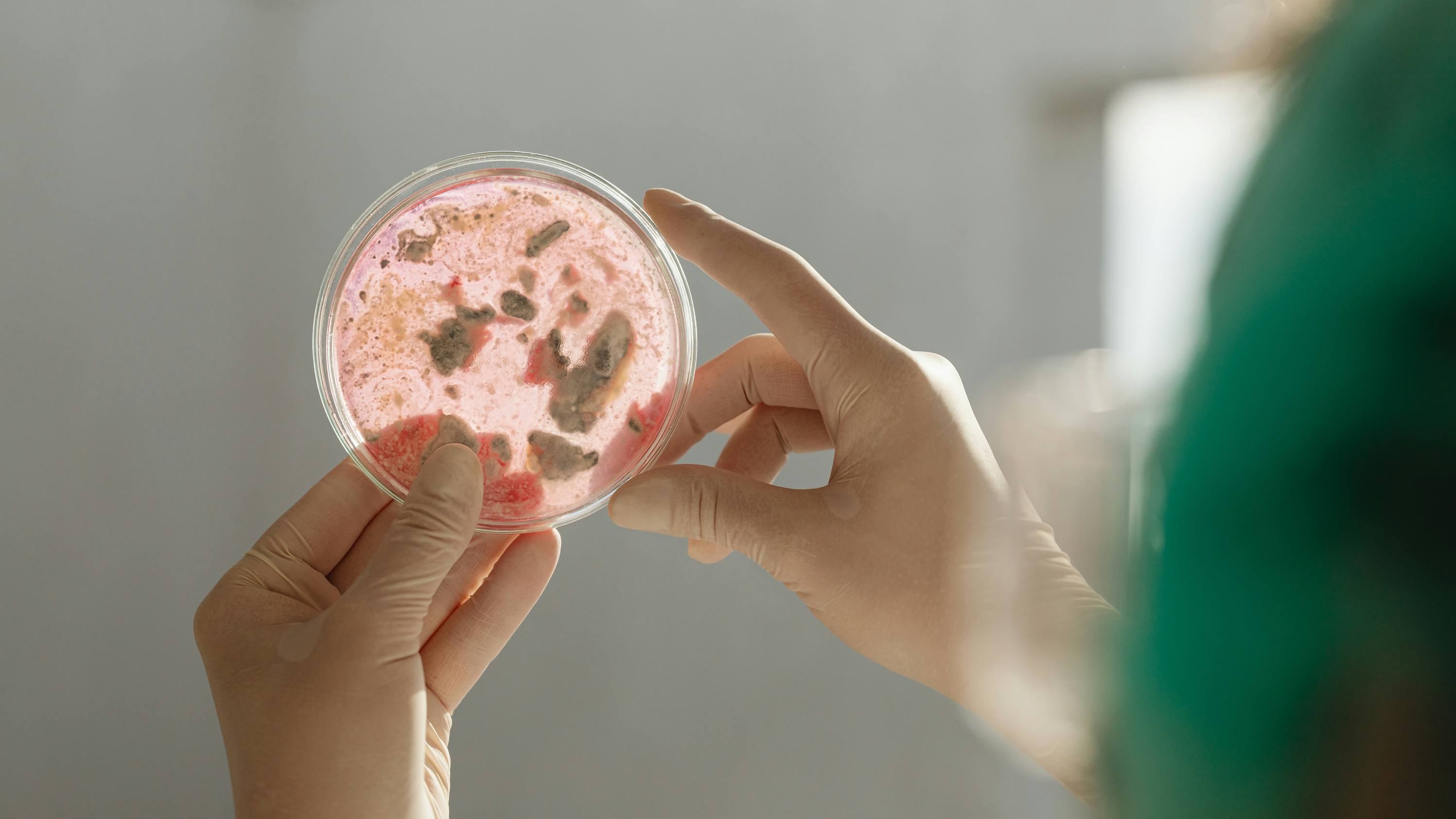 mikrobiota jelitowa - zdrowe jelita