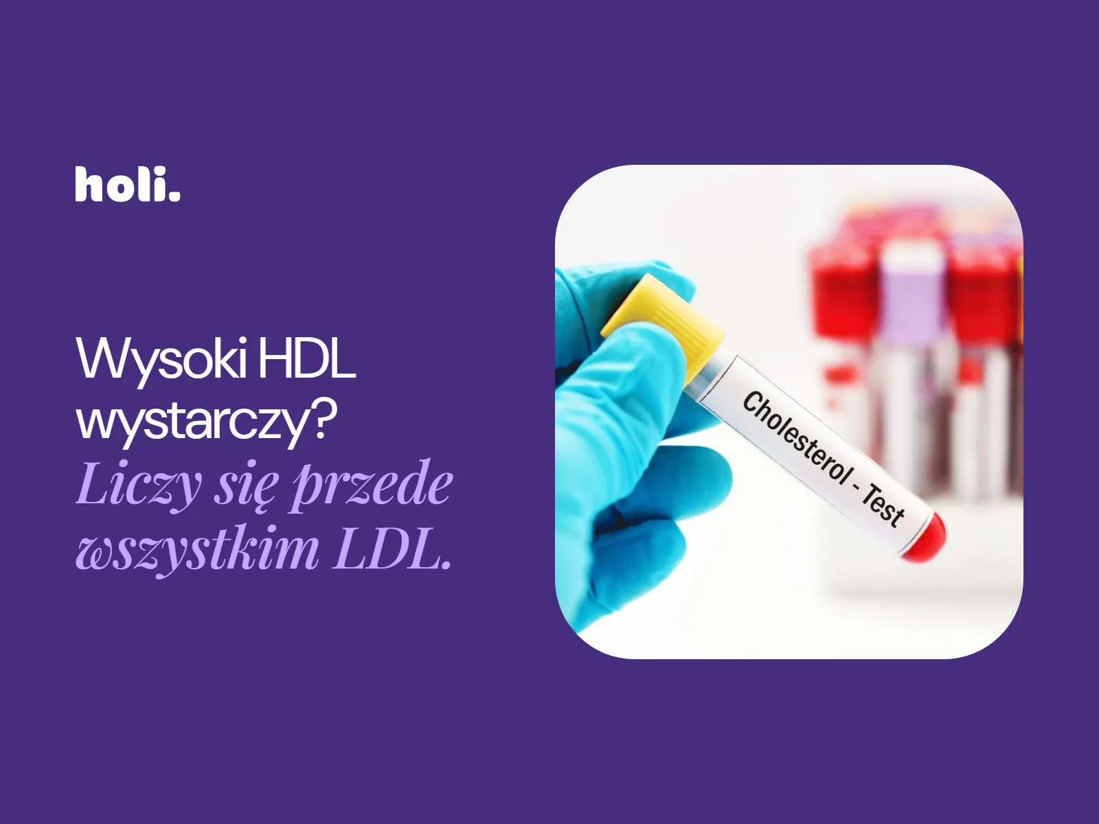 Okładka artykułu o normach cholesterolu: probówka z próbką krwi do badania cholesterolu, obok hasło „Wysoki HDL wystarczy? Liczy się przede wszystkim LDL.”