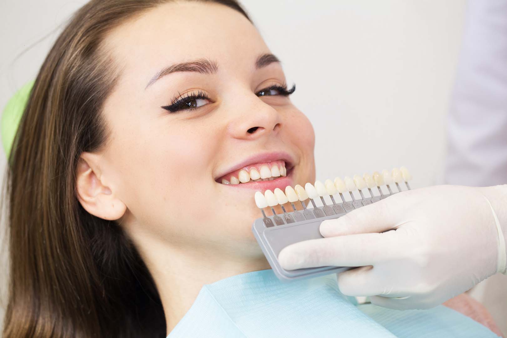 Veneers