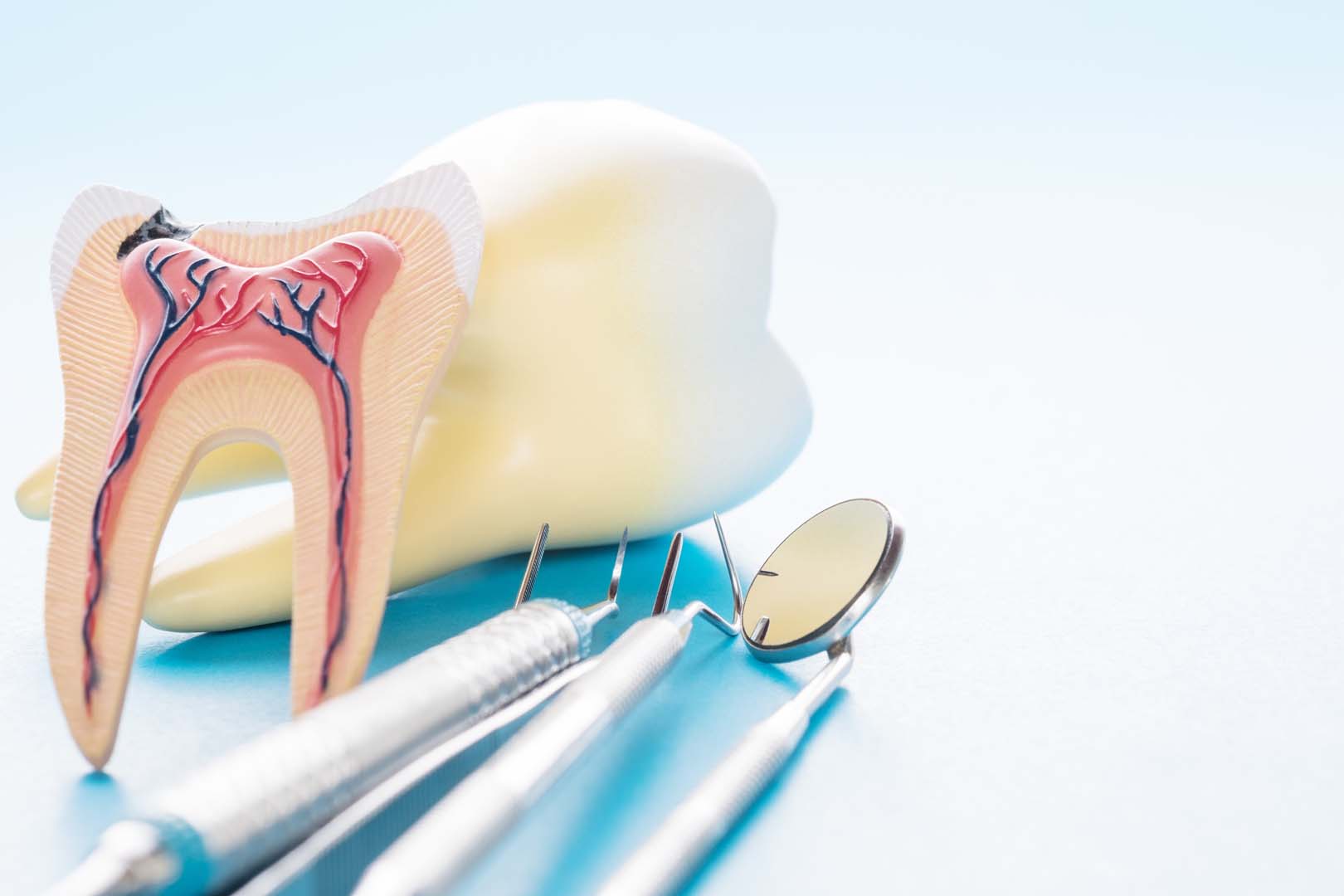 Root Canal Treatment