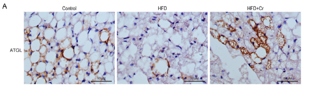 Liver fat cells comparison in three groups