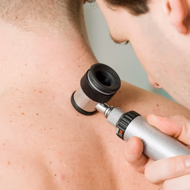 Untersuchung der Haut mit einem Dermatoskop