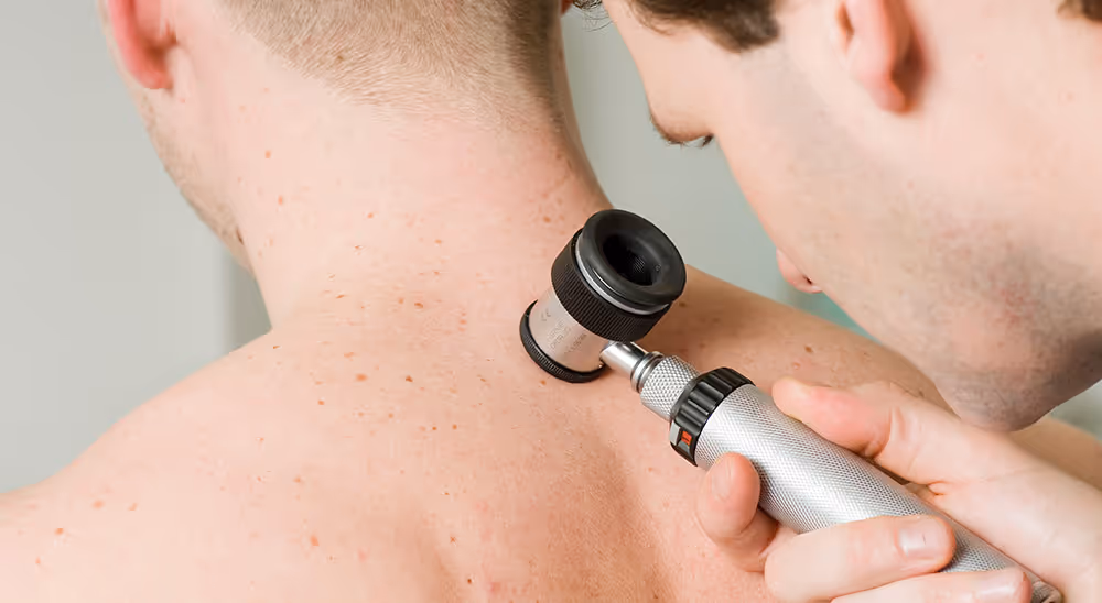 Dermatoskopische Untersuchung des Rückens einen Patienten.