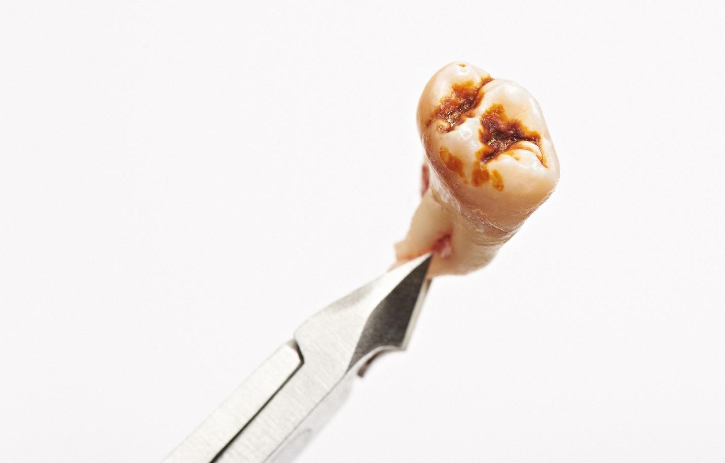 The Science of Cavities