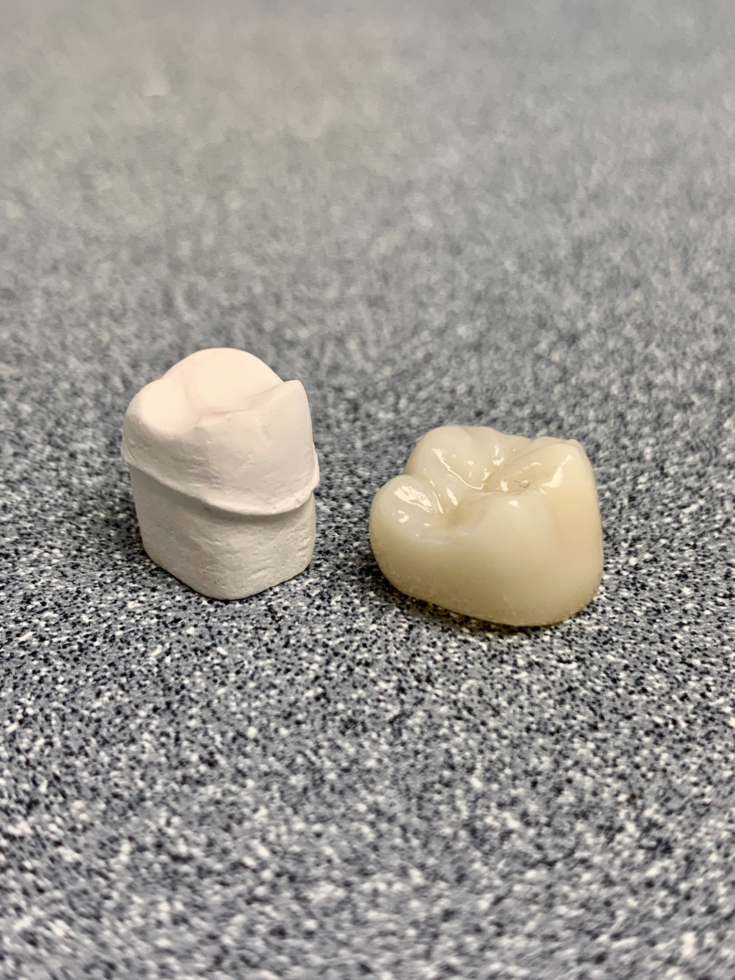 Cracked or Broken Dental Crown? We Can Help!