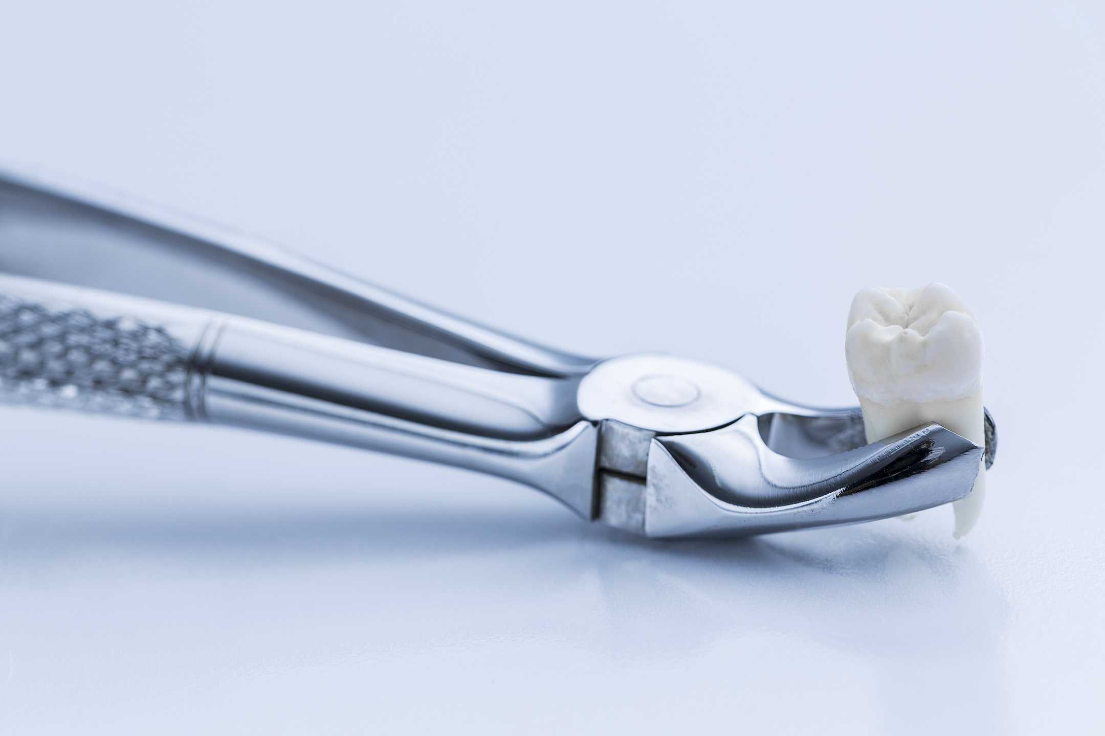Diabetes & Tooth Loss – Everything You Need to Know