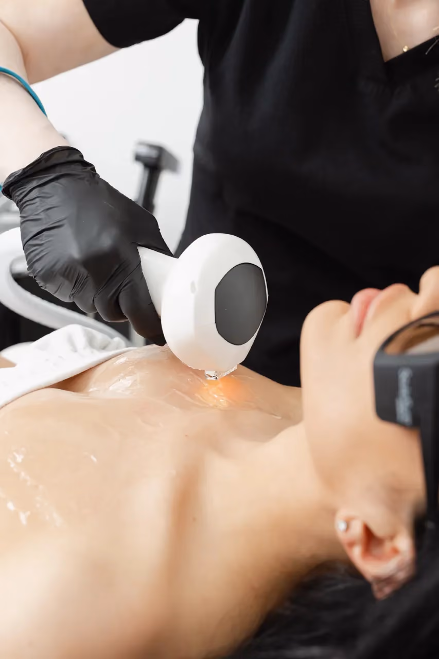 LUMECCA IPL Skin Treatment For Optimal Rejuvenation