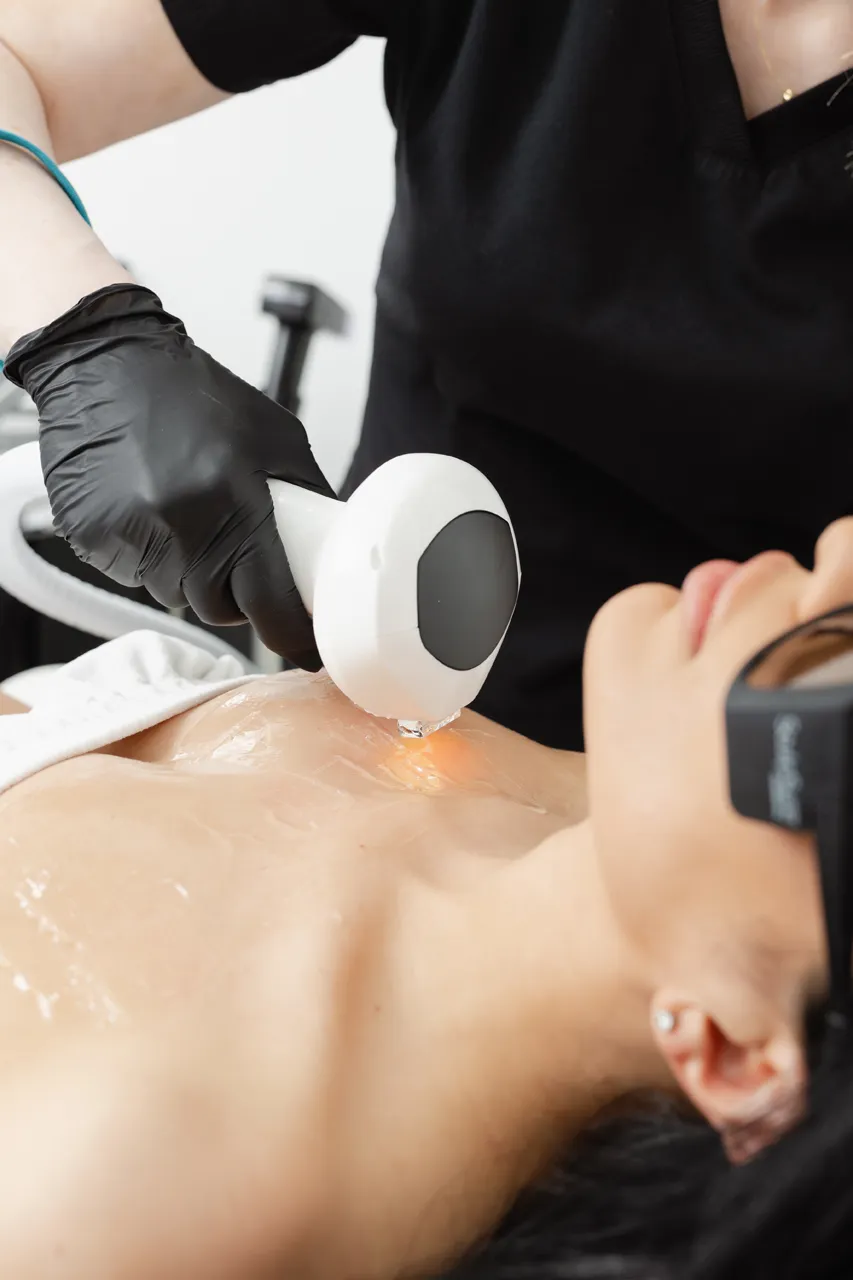Lumecca IPL